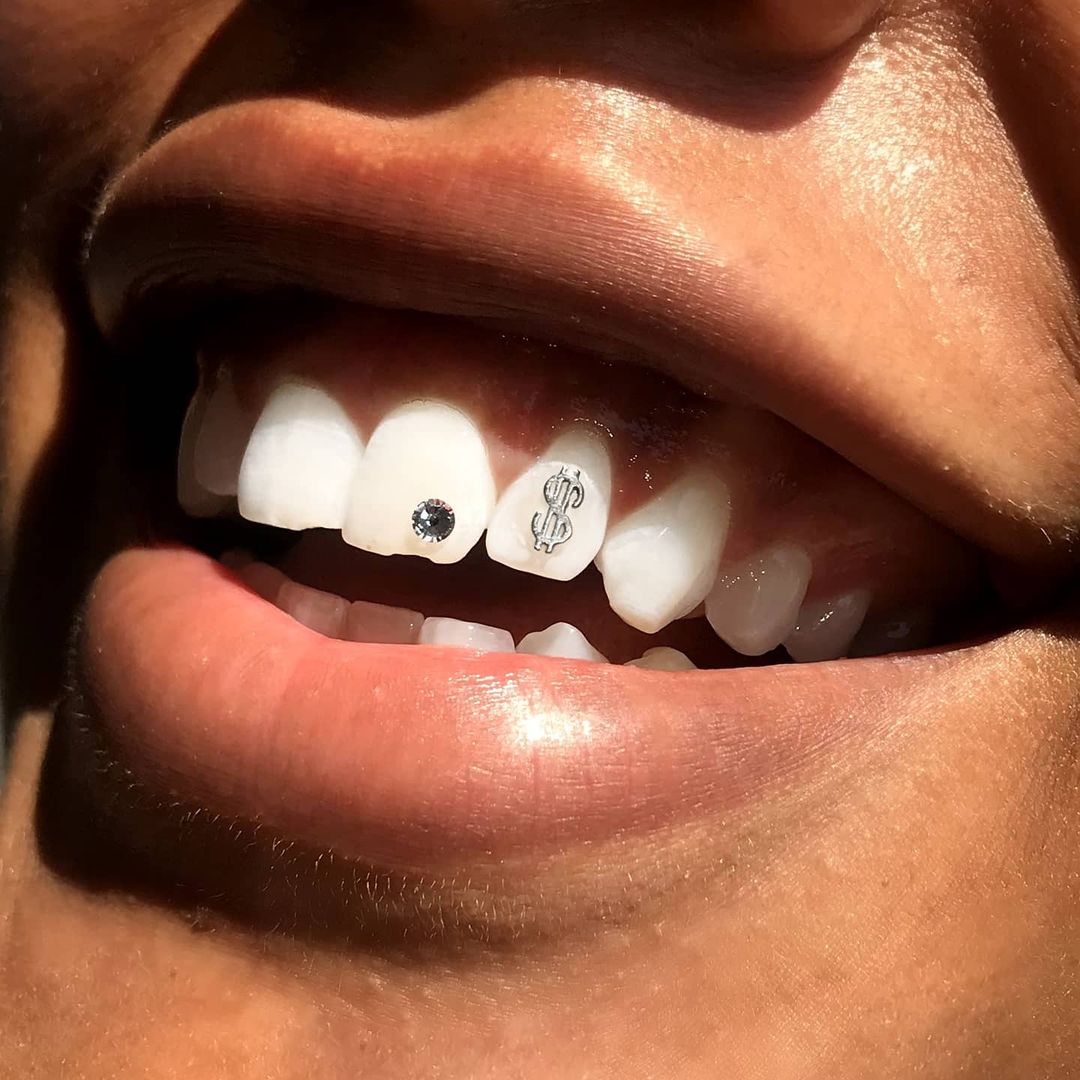 Tooth Gem Kits -  Norway